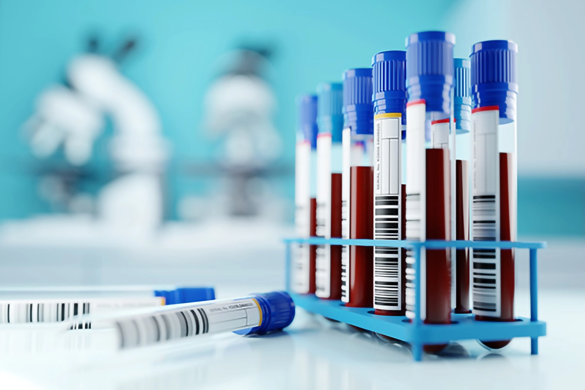 test tubes